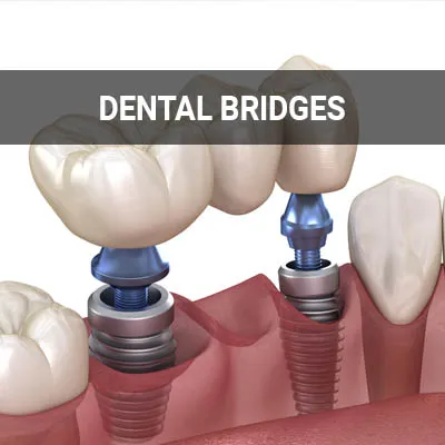 Visit our Dental Bridges page