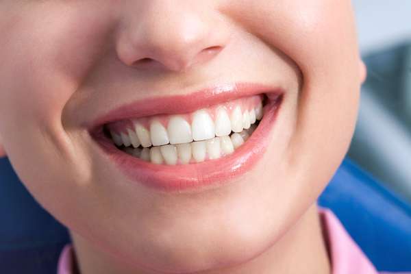 A General Dentist Discusses the Benefits of Tooth Straightening from My Smile Family Dental in Santa Ana, CA