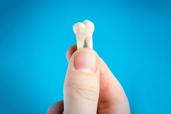 A General Dentist Helps You Decide Whether To Pull or Save a Tooth from My Smile Family Dental in Santa Ana, CA