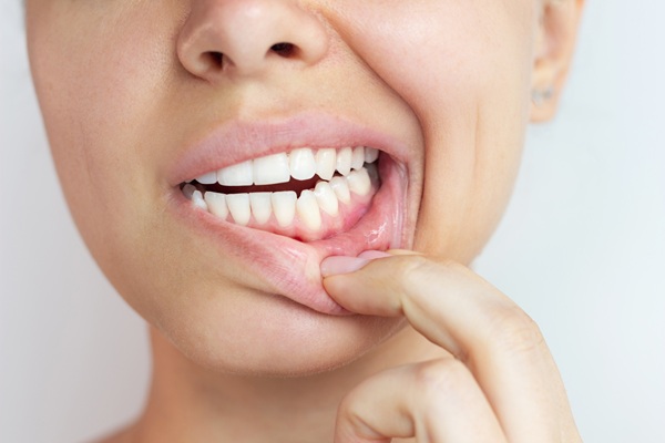 Gum Disease Treatment Options From A General Dentist