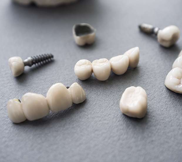 Santa Ana The Difference Between Dental Implants and Mini Dental Implants