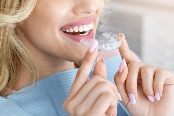 Are Invisalign Aligners Custom Made?